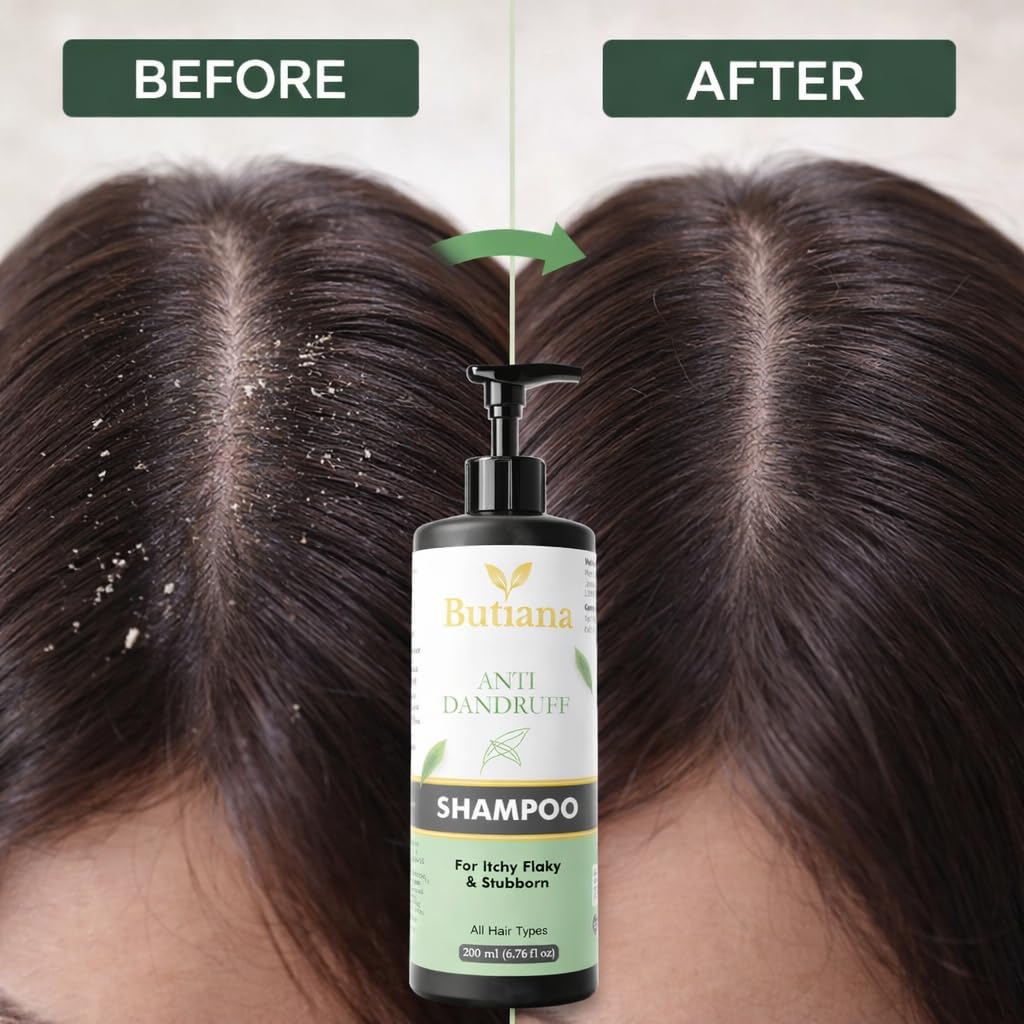 Butiana Anti Dandruff Shampoo for Itchy Flaky Scalp | Dandruff Control, Scalp Soothing & Deep Cleansing Formula for Healthy, Clean Hair | Suitable for All Hair Types – 200ml