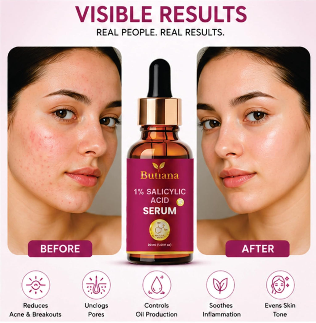 Butiana 1% Salicylic Acid Face Serum 30ml – Acne Control, Oil Balance, Pore Minimizing, Blackhead Removal, Gentle Exfoliation for Clear, Smooth & Healthy Skin