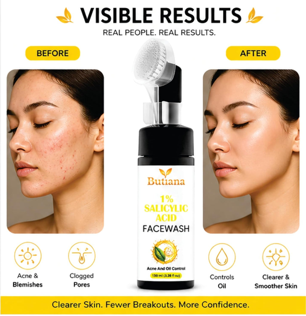 Butiana 1% Salicylic Acid Face Wash 150ml – Acne Control Cleanser with Tea Tree, Niacinamide & Aloe Vera, Oil Control, Pore Cleansing, Gentle Daily Face Cleanser for Clear Skin