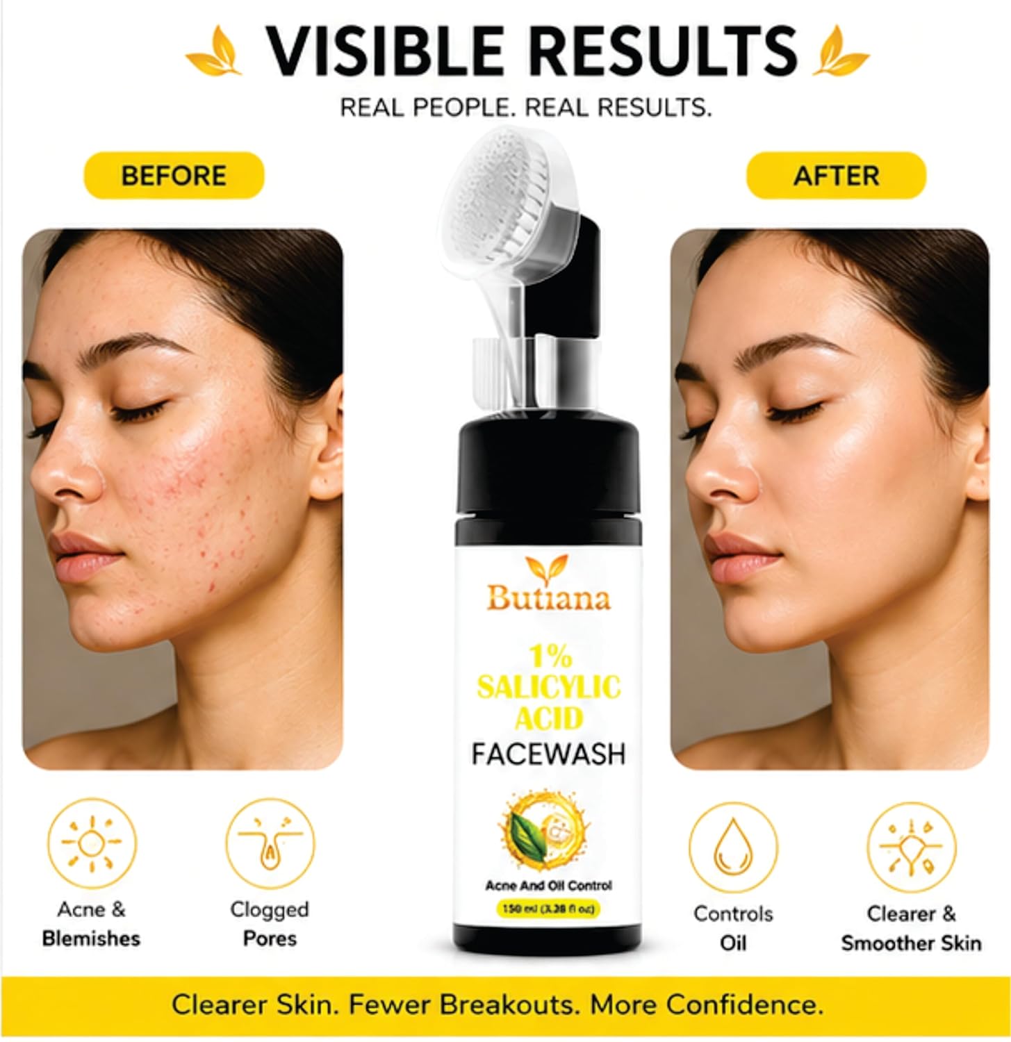 Butiana 1% Salicylic Acid Face Wash 150ml – Acne Control Cleanser with Tea Tree, Niacinamide & Aloe Vera, Oil Control, Pore Cleansing, Gentle Daily Face Cleanser for Clear Skin