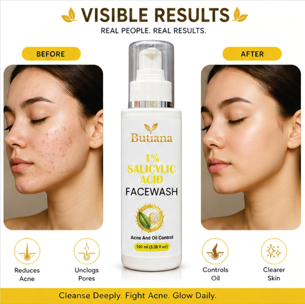 Butiana 1% Salicylic Acid Face Wash 100ml – Acne Control Cleanser with Tea Tree, Niacinamide & Aloe Vera, Oil Control, Pore Cleansing, Gentle Daily Face Cleanser for Clear Skin