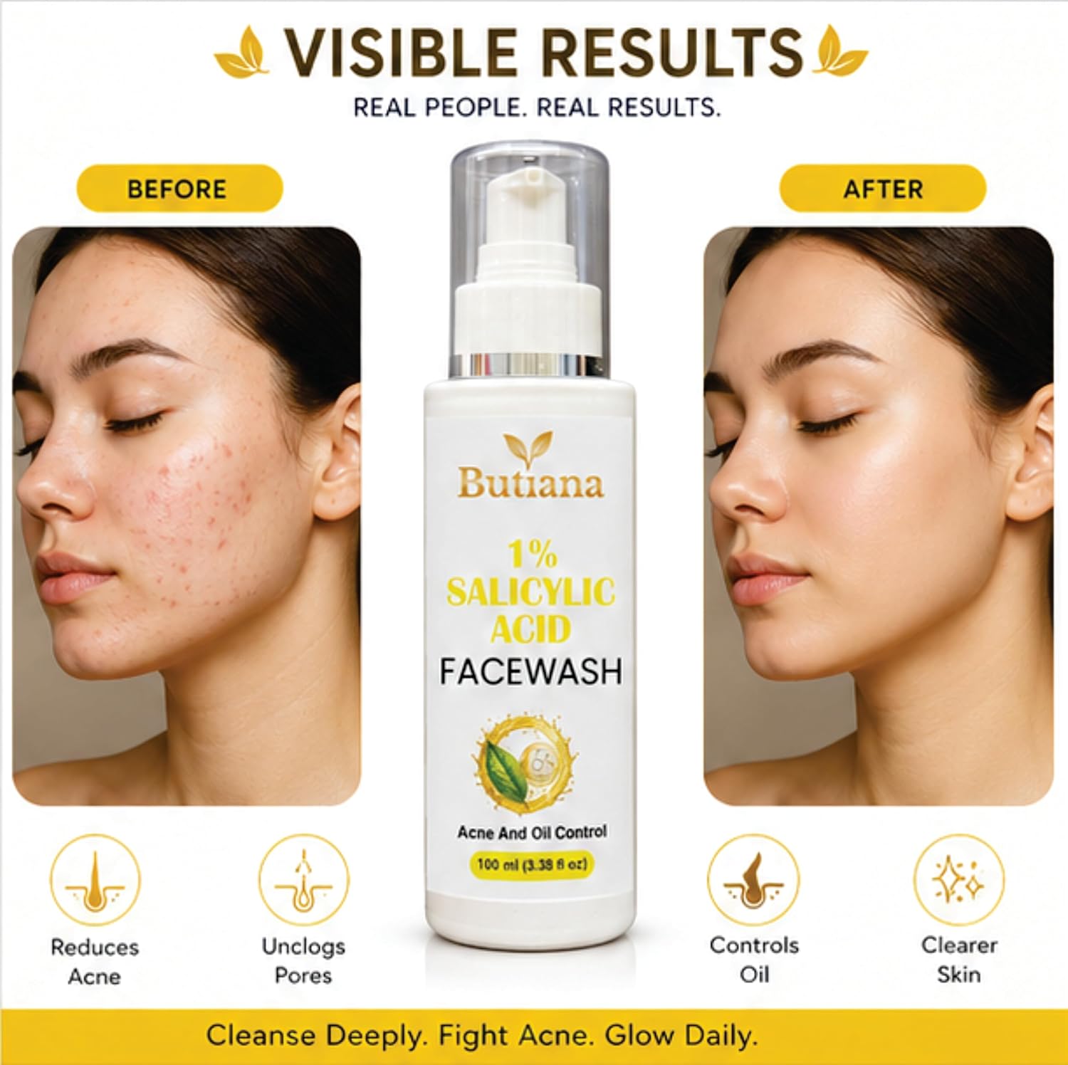 Butiana 1% Salicylic Acid Face Wash 100ml – Acne Control Cleanser with Tea Tree, Niacinamide & Aloe Vera, Oil Control, Pore Cleansing, Gentle Daily Face Cleanser for Clear Skin