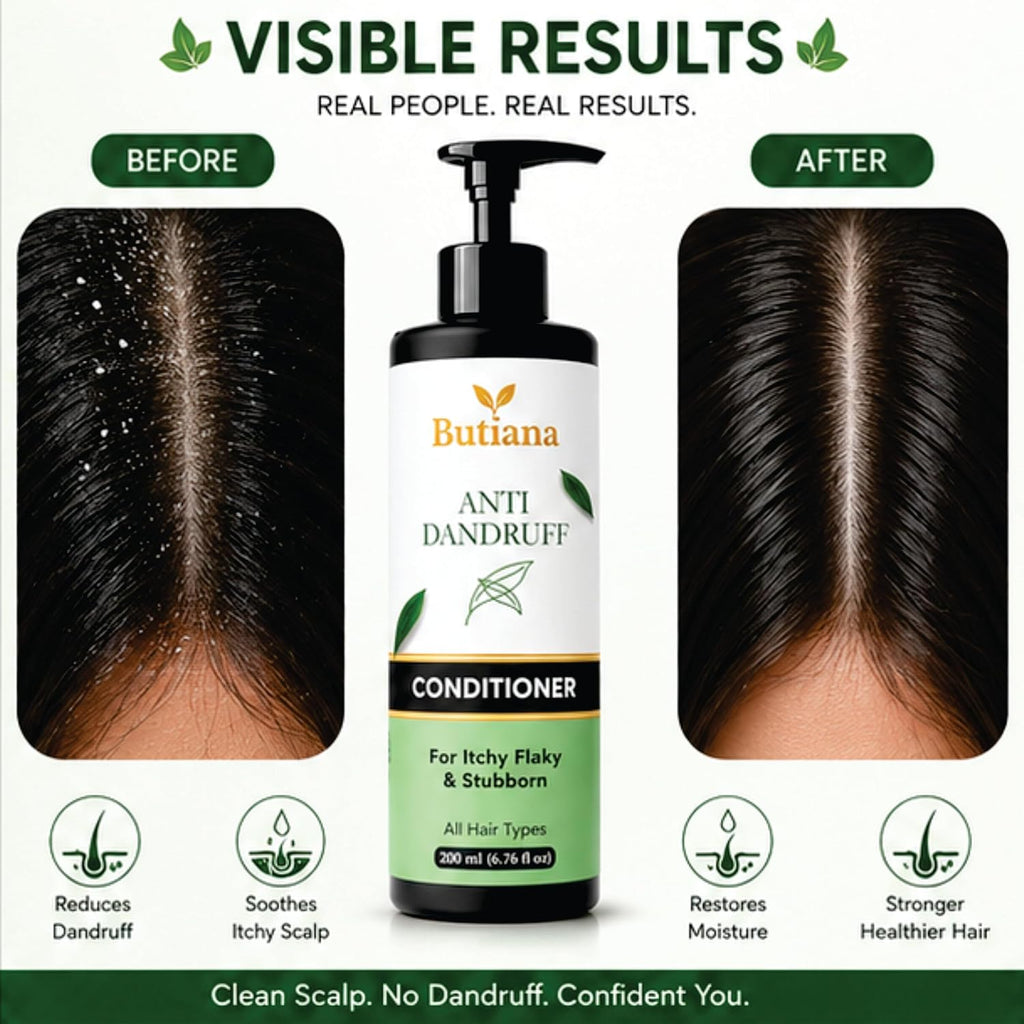 Butiana Anti Dandruff Hair Conditioner 200ml – Scalp Soothing, Flake Control, Hydrating & Smoothening Conditioner for Itchy, Dry & Flaky Scalp, All Hair Types Men & Women