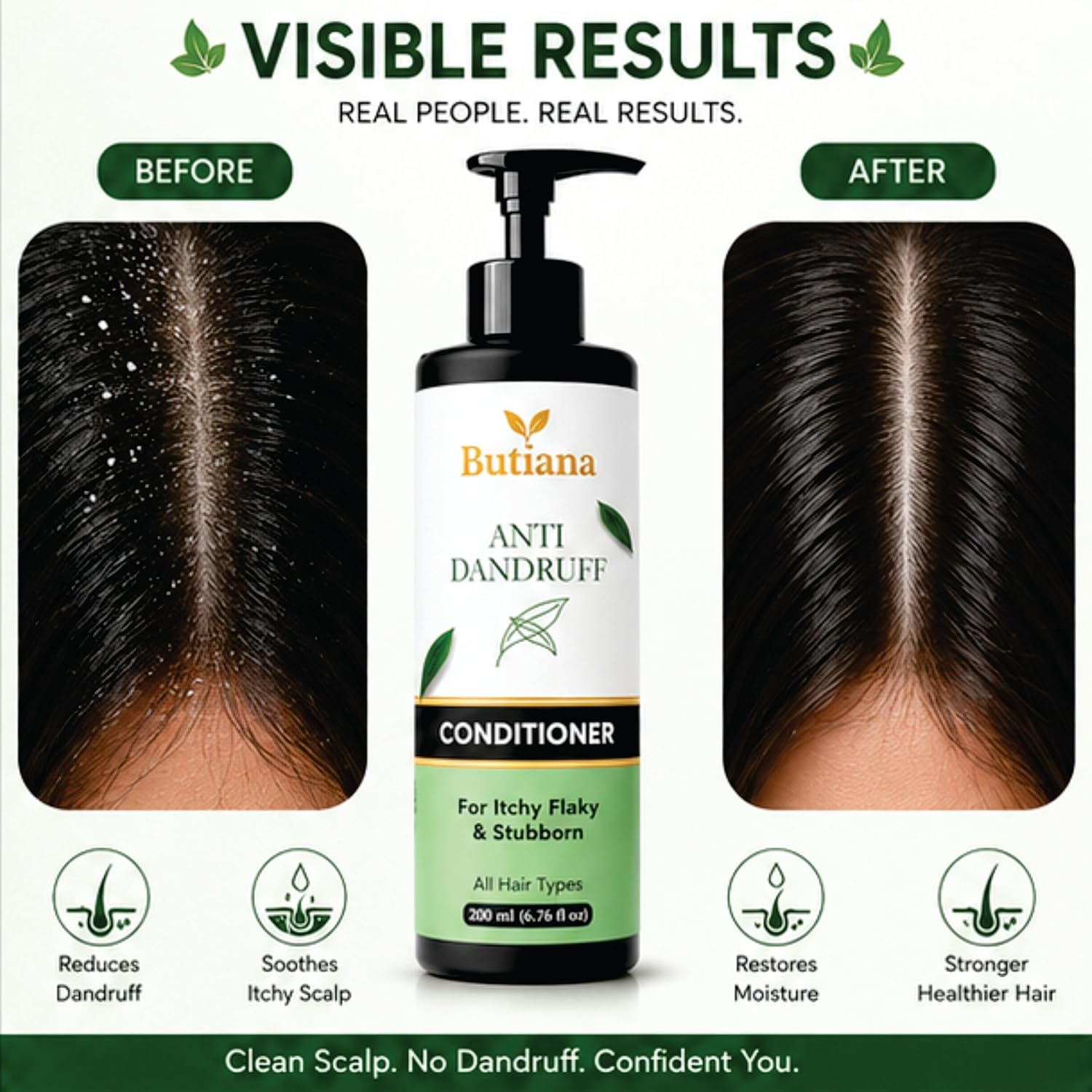 Butiana Anti Dandruff Hair Conditioner 200ml – Scalp Soothing, Flake Control, Hydrating & Smoothening Conditioner for Itchy, Dry & Flaky Scalp, All Hair Types Men & Women